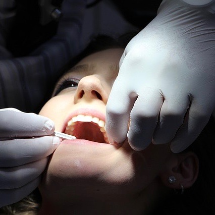 Rêver de dents : quelle signification ?